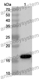 Anti-Human GCSH Polyclonal Antibody