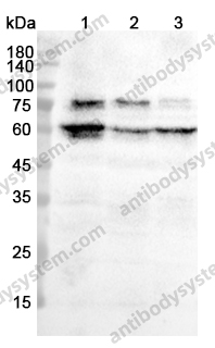 Anti-S6K1/RPS6KB1 Polyclonal Antibody