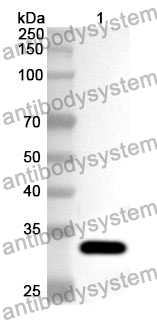 Anti-JAK1 Polyclonal Antibody