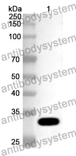 Anti-PTPRB Polyclonal Antibody