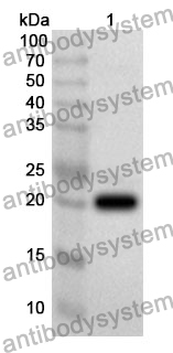 Anti-PTPRZ1 Polyclonal Antibody