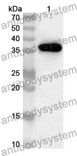 Anti-Human MCC Polyclonal Antibody