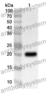 Anti-CFL1 Polyclonal Antibody