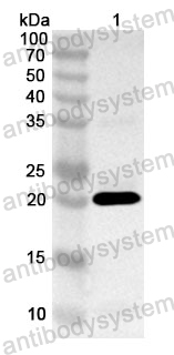 Anti-Human EIF4B Polyclonal Antibody