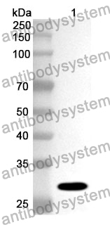 Anti-Human ITPKA Polyclonal Antibody