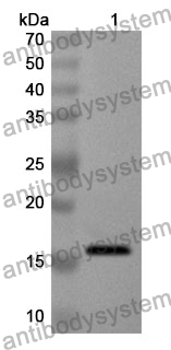 Anti-Human DGKA Polyclonal Antibody