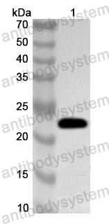 Anti-Human VAMP1 Polyclonal Antibody