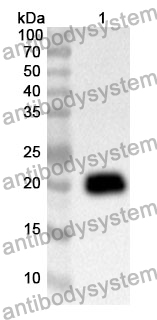 Anti-DTYMK Polyclonal Antibody