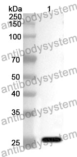 Anti-RRM1 Polyclonal Antibody