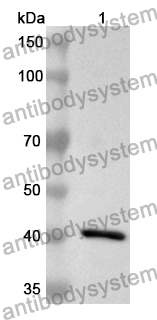 Anti-Human FSHR Polyclonal Antibody