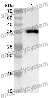 Anti-CRHBP Polyclonal Antibody