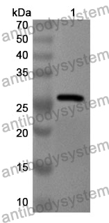 Anti-Human CD124/IL4R Polyclonal Antibody