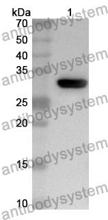 Anti-Human EDNRB/ETRB Polyclonal Antibody