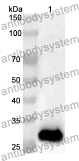 Anti-EEF1B2 Polyclonal Antibody