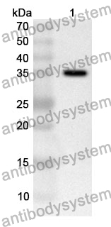 Anti-ACAT1 Polyclonal Antibody