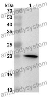 Anti-MYL9 Polyclonal Antibody