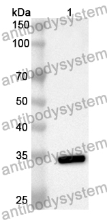 Anti-CDK2 Polyclonal Antibody