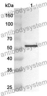 Anti-GRK2 Polyclonal Antibody