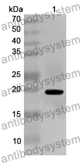 Anti-EDNRA Polyclonal Antibody