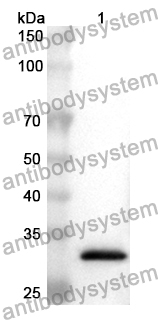 Anti-Human TACR1 Polyclonal Antibody