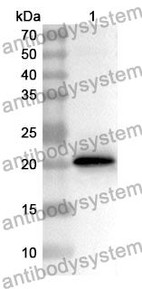 Anti-AZGP1 Polyclonal Antibody