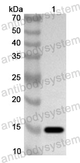 Anti-Human BRD2 Polyclonal Antibody