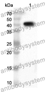 Anti-HSP40/DNAJB1 Polyclonal Antibody