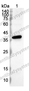 Anti-HSP40/DNAJB1 Polyclonal Antibody