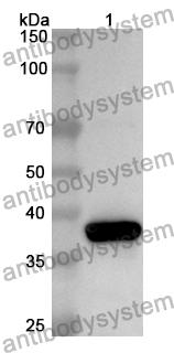 Anti-Human DNAJB2 Polyclonal Antibody