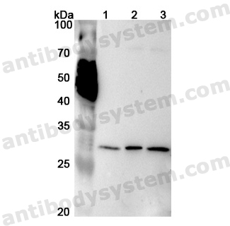 Anti-Human PSMA4 Polyclonal Antibody