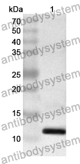 Anti-S100P Polyclonal Antibody