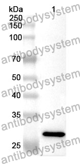 Anti-NFKBIA Polyclonal Antibody