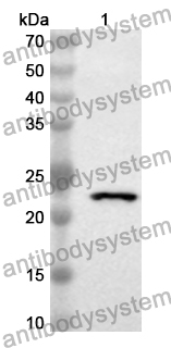 Anti-Human DNMT1 Polyclonal Antibody