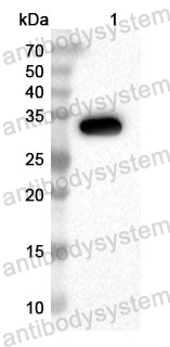 Anti-Human HSD3B2 Polyclonal Antibody