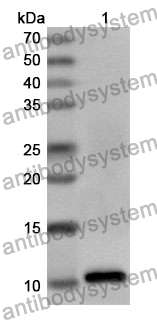 Anti-Human ZFP36 Polyclonal Antibody