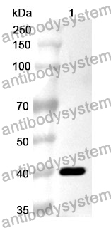 Anti-ACVR2A Polyclonal Antibody