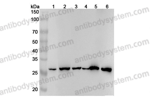 Anti-YWHAQ Polyclonal Antibody