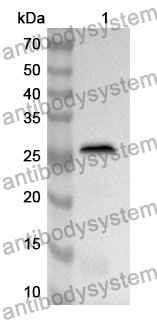 Anti-CBLIF Polyclonal Antibody