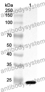 Anti-Human G0S2 Polyclonal Antibody