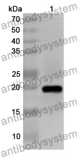 Anti-CALML3 Polyclonal Antibody