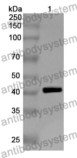 Anti-CD26/DPP4 Polyclonal Antibody