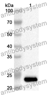 Anti-ARNT/HIF1-beta Polyclonal Antibody