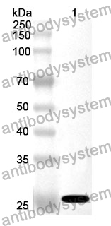 Anti-RPL10 Polyclonal Antibody