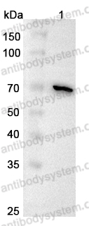 Anti-COL8A1 Polyclonal Antibody