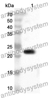 Anti-Calreticulin/CALR Polyclonal Antibody