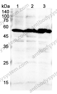 Anti-Calreticulin/CALR Polyclonal Antibody