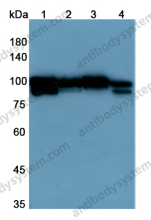 Anti-CANX Polyclonal Antibody