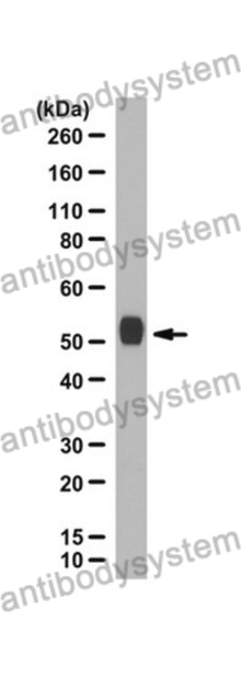 Anti-CFP Polyclonal Antibody