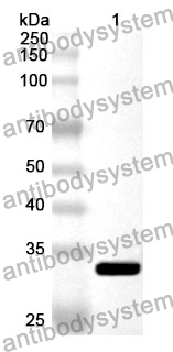 Anti-AOAH Polyclonal Antibody