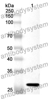 Anti-PSMB6 Polyclonal Antibody